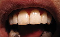 Odontología restauradora