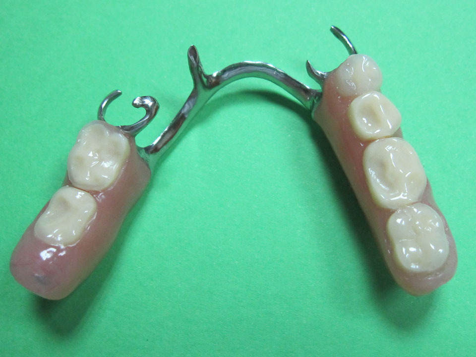 Prótesis dentales : Dental