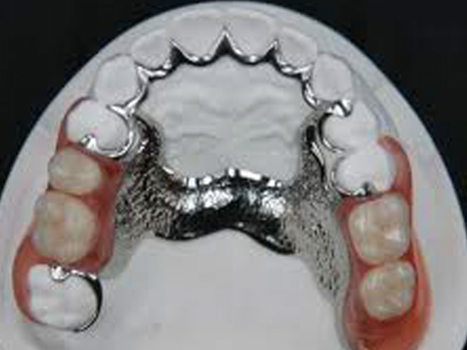 prisión lb Ru Prótesis dentales : Instituto Dental